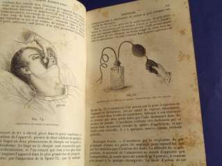   OPERATOIRE   MALGAIGNE   PLASTIC SURGERY   AMPUTATIONS ETC 2 VOLS 1874