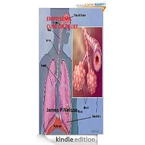 Emphysema Cure or Relief James Nelson  Kindle Store